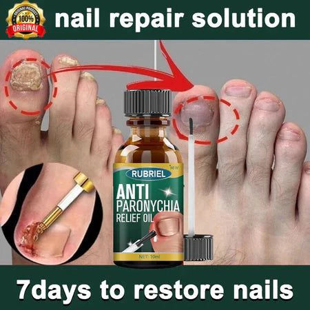 Anti Paronychia Relief Oil- Buy 1 Get 1 Free